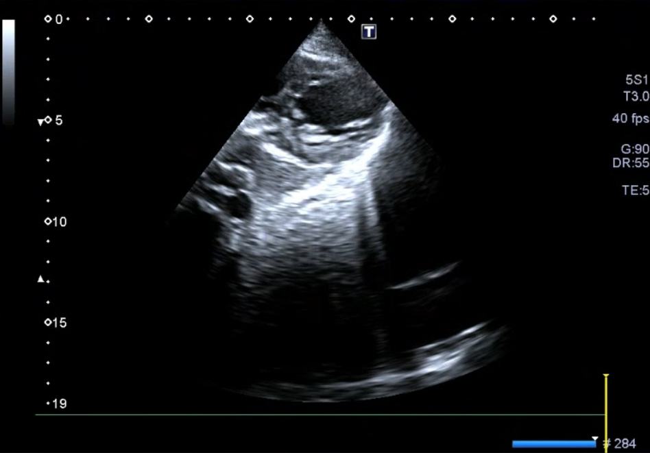 Ecocolordoppler cardiaco