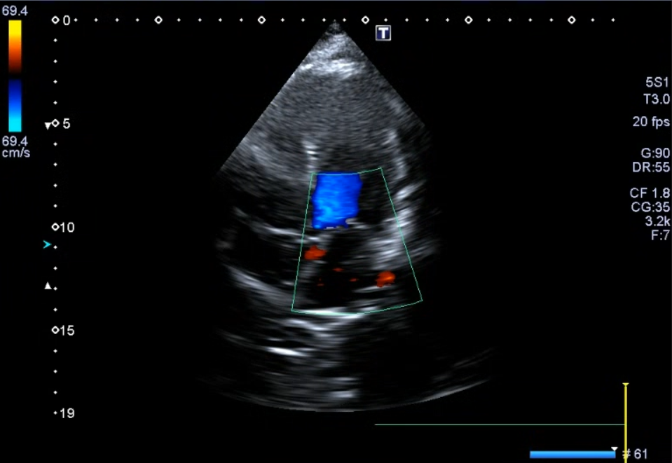 Monitoraggio cardiologico