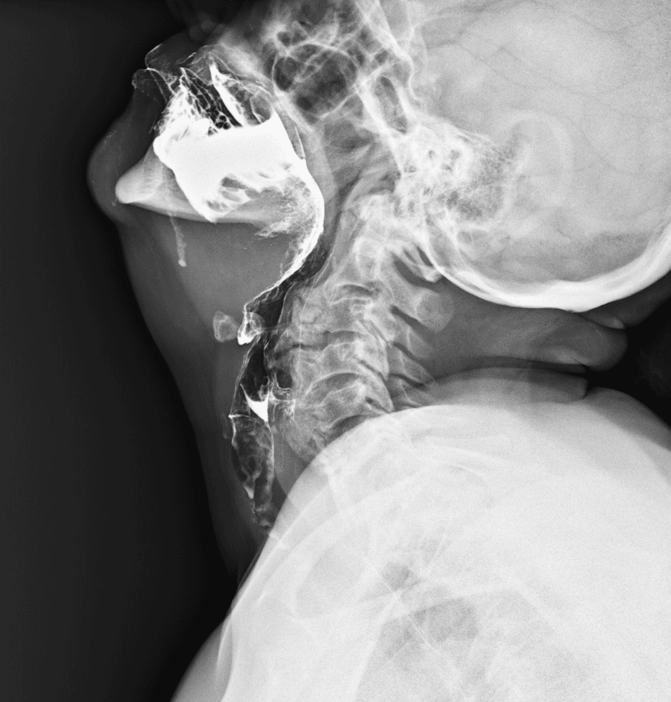 Esami radiologici gastro-intestinali