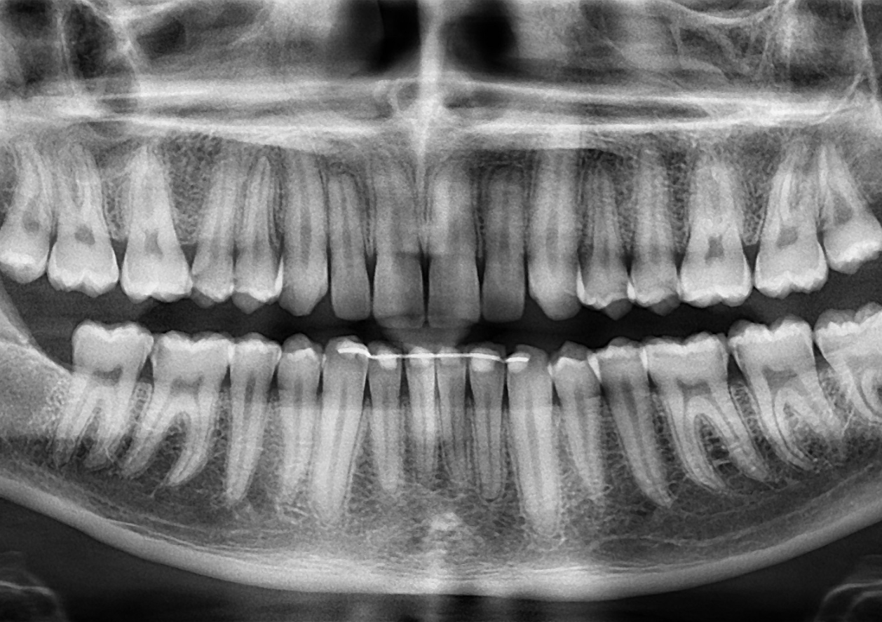 Radiologia odontoiatrica Cedir