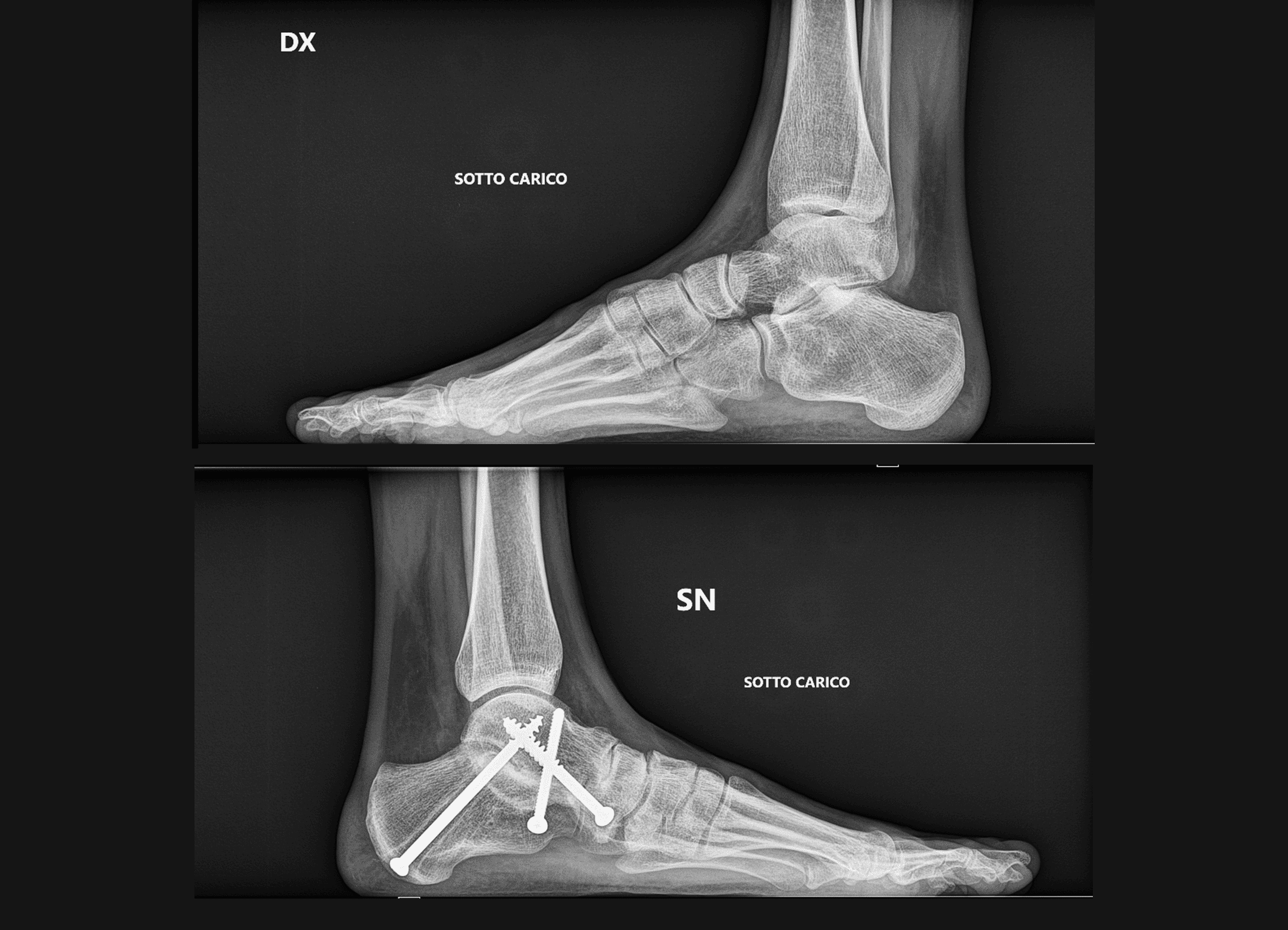 Esami radiografici sotto carico