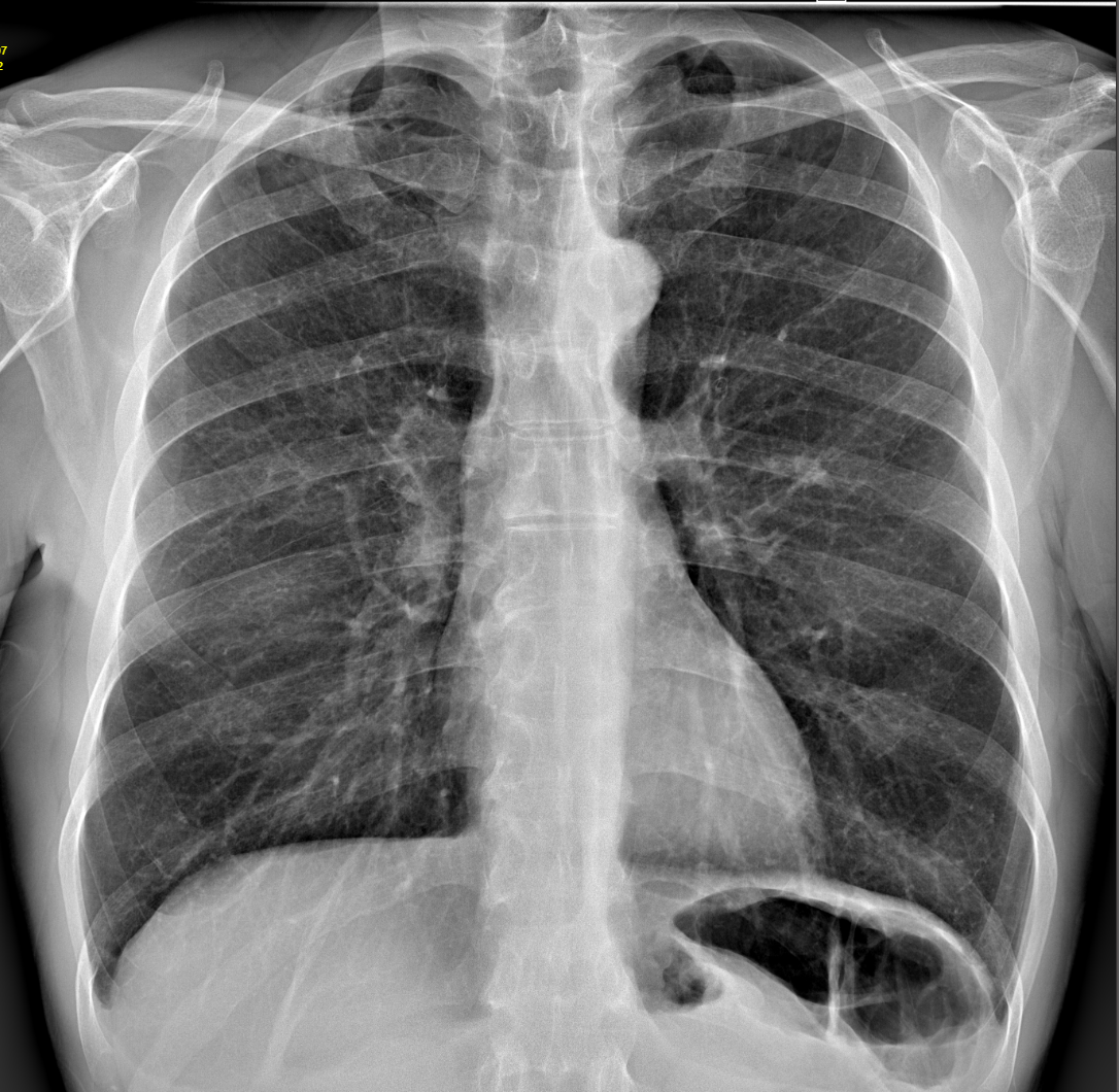Radiologia digitale Cedir